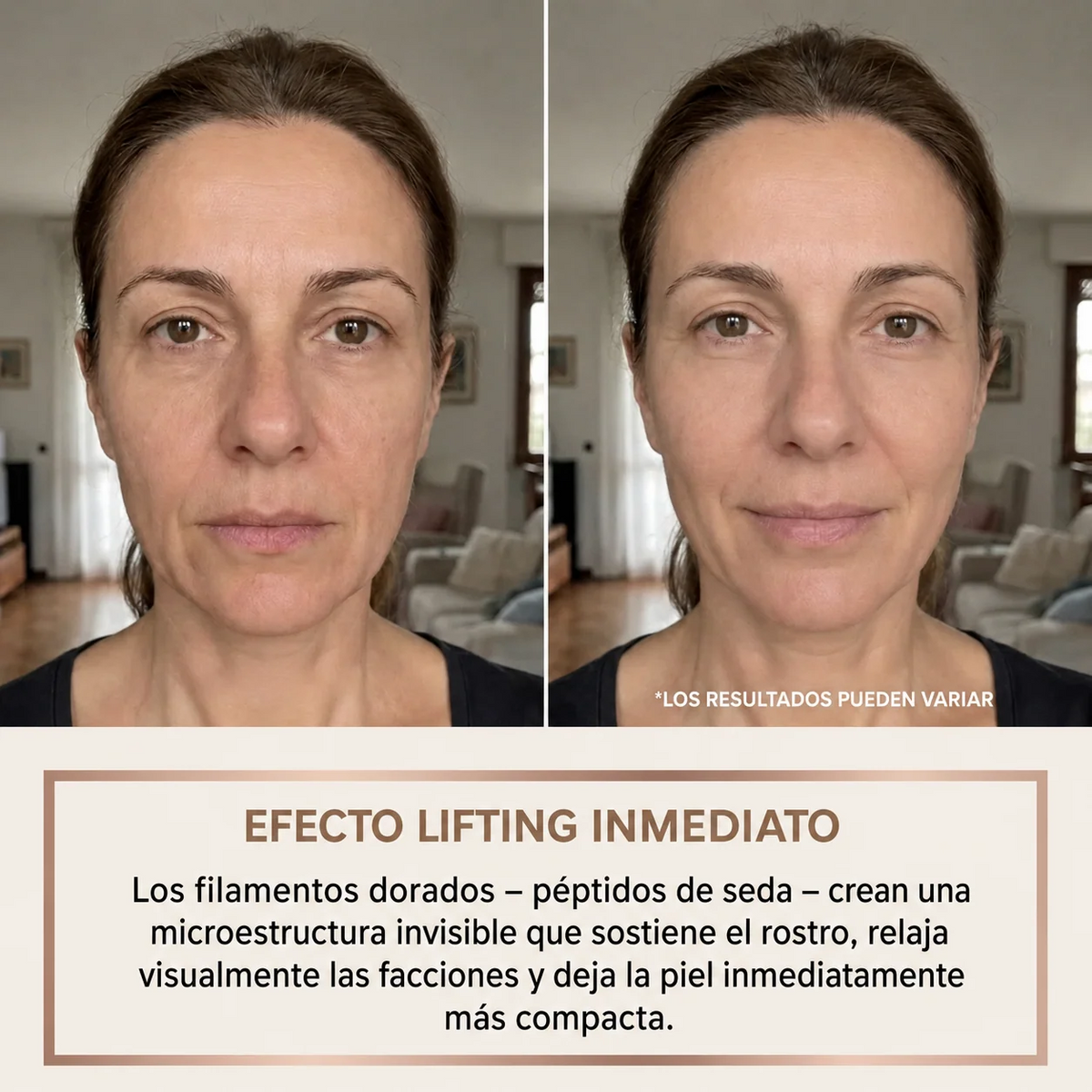 SilkLift™ – Sérum Coreano Efecto Lifting desde la Primera Aplicación